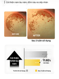 centellian24+ mela q advanced cream 55ml